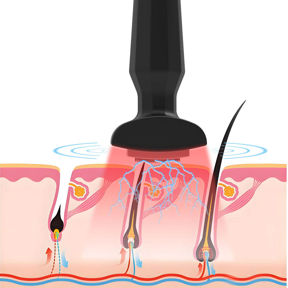 4-in-1 Electric Head Massager Red Light EMS Vibration Microcurrent Derma Stamp Beard Scalp Massager for Hair Growth