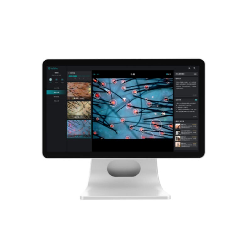 Professional Hair Mirror Scalp Analyzer Hair Follicle Analyzer with Pigmentation Blood Scab Diagnosis