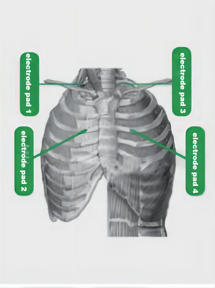 Frequency Conversion Portable External Diaphragm Pacemaker