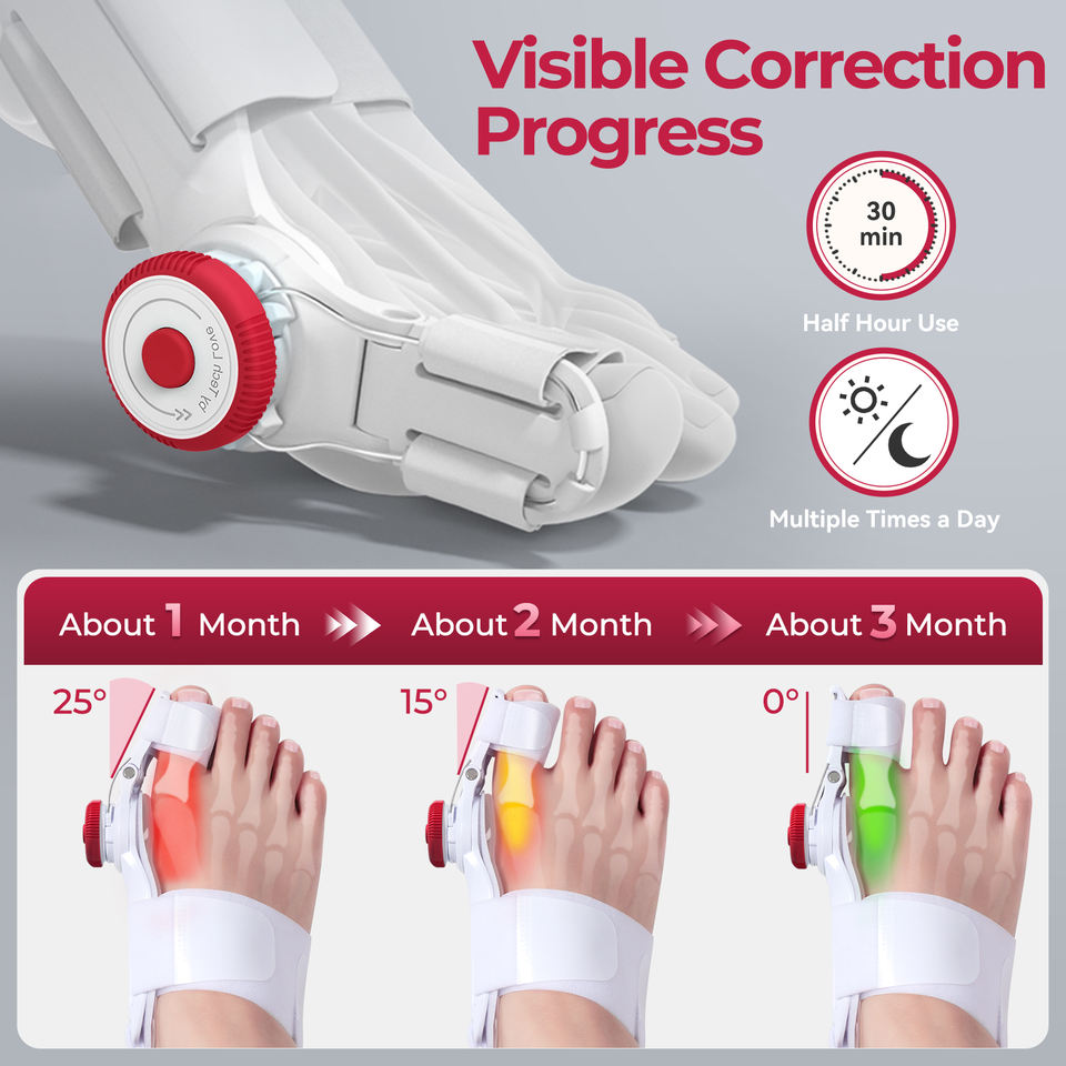 Children Bunion Recovery Corrector with Soft Flexible Frame for Pain Relief Powerful Alignment and Night Support