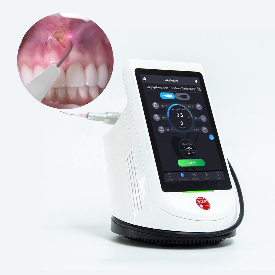 Portable Diode Dental Laser Machine 450nm 650nm 980nm for Oral Soft Tissue Surgery