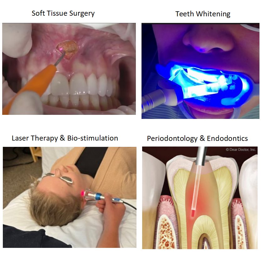 Portable Diode Dental Laser Machine 450nm 650nm 980nm for Oral Soft Tissue Surgery