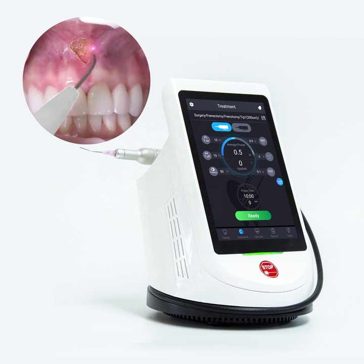 Portable Diode Dental Laser Machine 450nm 650nm 980nm for Oral Soft Tissue Surgery