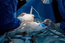 Surgical Instruments