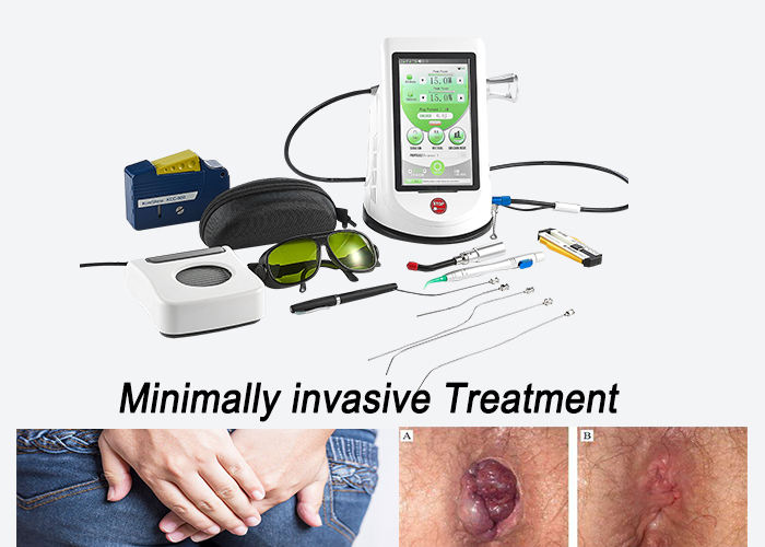 Berylas 1470nm 12W Electricity Powered CE Certified Surgery Laser for Proctology Hemorrhoid Fistula Fissure Sinus Treatment