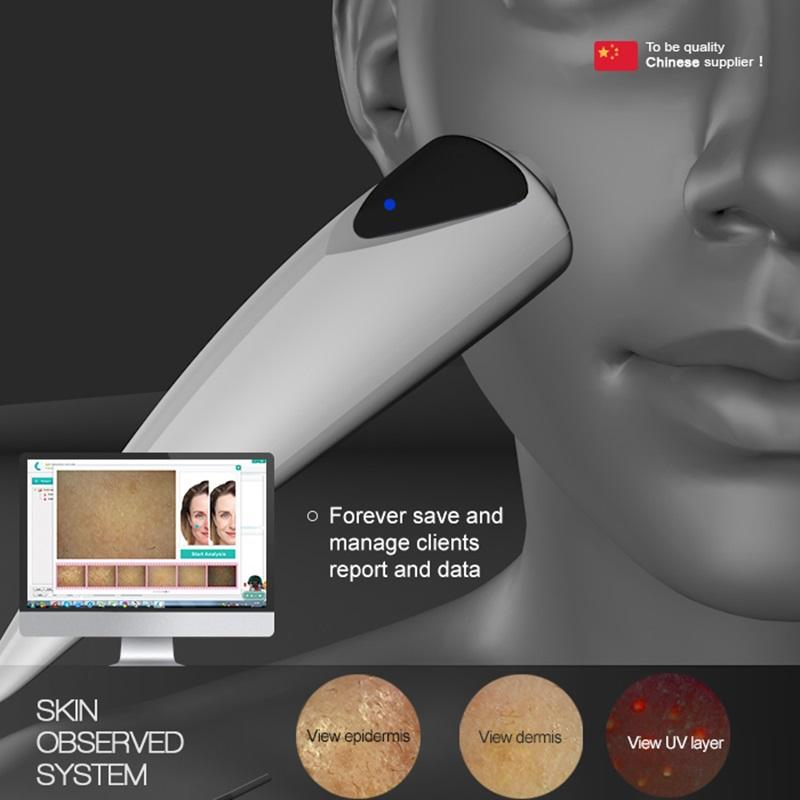 Household Intelligent Skin Detector 4K Epidermis/Dermis Elasticity Assessment Acne Detection Texture Analysis HD Image Report